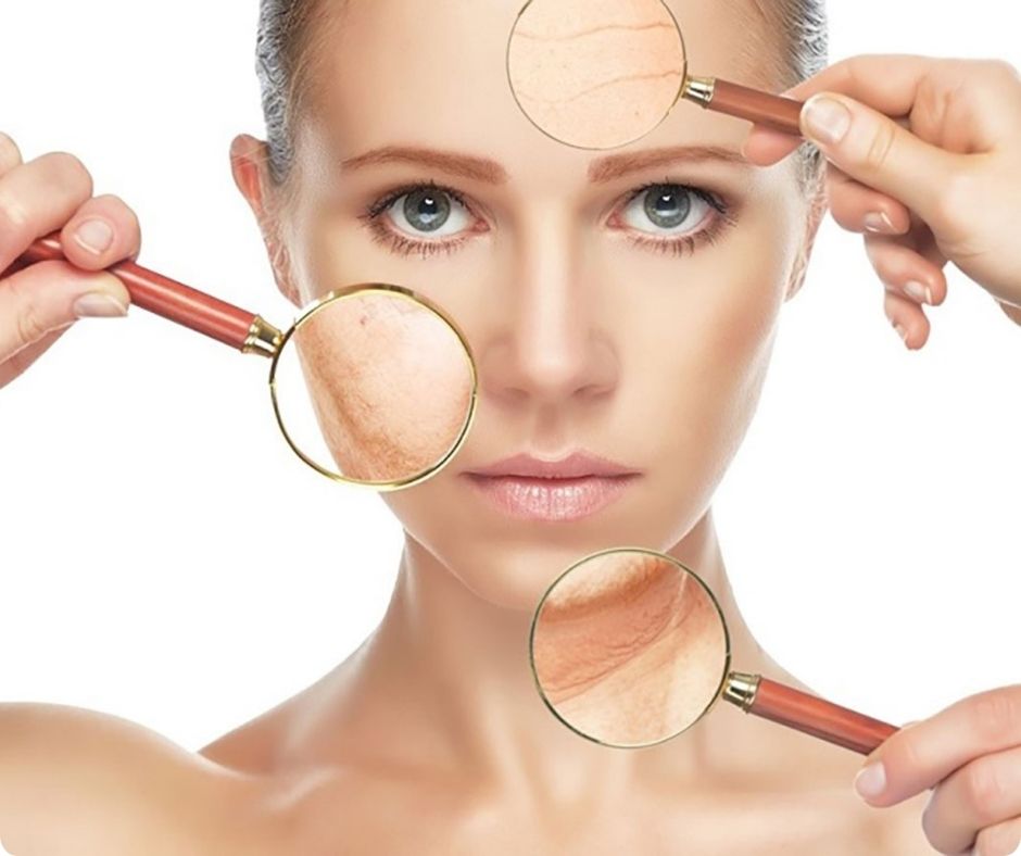 các dấu hiệu lão hóa da thường gặp như nếp nhăn và da bị chảy xệ