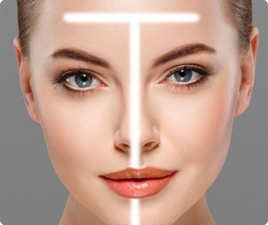 Cận cảnh làn da bóng dầu và lỗ chân lông to ở vùng mũi